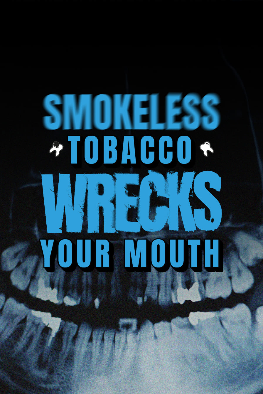 Hookah smokers are more likely to get gum disease and lose teeth than non-smokers.